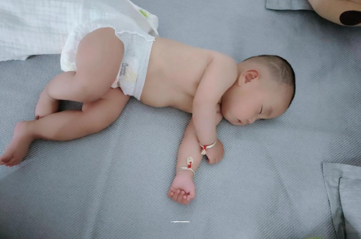 忻州宝宝头上长痱子